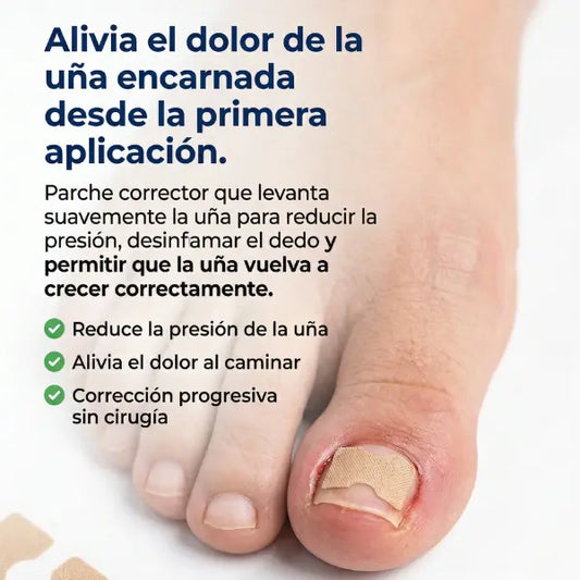Tratamiento con Parches Correctores para Uñas Encarnadas
